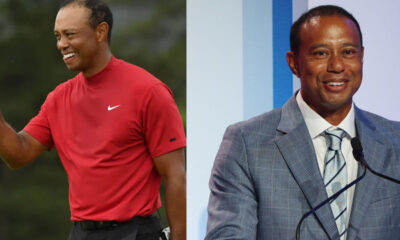 tiger woods hair transplant
