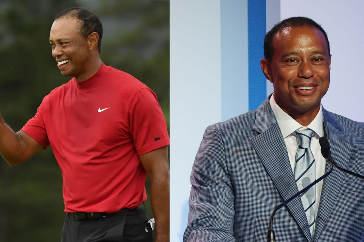 tiger woods hair transplant